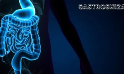 Gastroshiza
