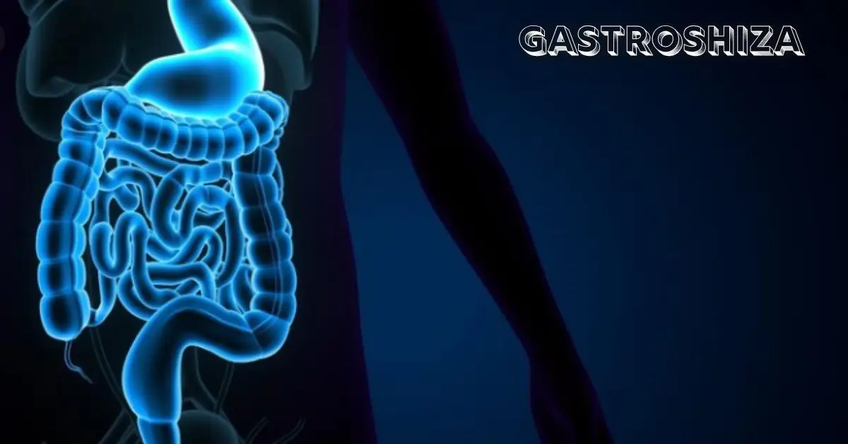 Gastroshiza